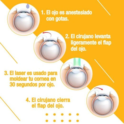 Cirugia-ocular-laser-lasik-dr-rincon-procedimiento