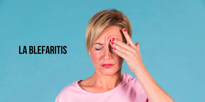 que-es-blefaritis, síntomas y causas